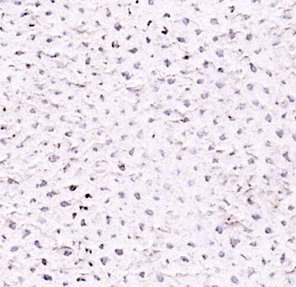 Yayoi Kusama, Accumulation Series: No. F, 1962